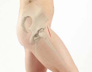 https://www.joshuahickmanmd.com/3d-images/anterior-hip-replacement.jpg